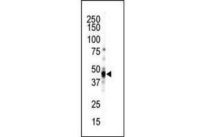 Western blot analysis of anti-CK1-like C-term Pab (ABIN391307 and ABIN2841342) in NCI cell lysate. (CAMK1D antibody  (C-Term))