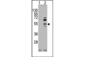 Image no. 1 for anti-Myocyte Enhancer Factor 2C (MEF2C) (Ser59) antibody (ABIN358803) (MEF2C antibody  (Ser59))