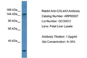 WB Suggested Anti-COL4A3  Antibody Titration: 0. (COL4a3 antibody  (N-Term))