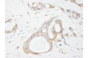 Immunohistochemistry (IHC) image for anti-Ubiquitin Specific Peptidase 5 (USP5) (AA 375-425) antibody (ABIN7449032) (USP5 antibody  (AA 375-425))