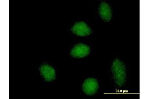 Immunofluorescence of purified MaxPab antibody to DNAJB6 on HeLa cell. (DNAJB6 antibody  (AA 1-326))