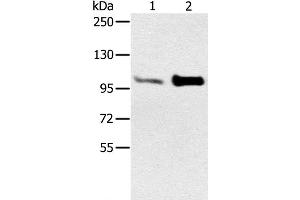 Western Blot analysis of Mouse muscle and heart tissue using ACTN2 Polyclonal Antibody at dilution of 1:300 (ACTN2 antibody)