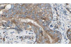 ABIN6277589 at 1/100 staining Human prostate tissue by IHC-P. (CBR1 antibody  (C-Term))