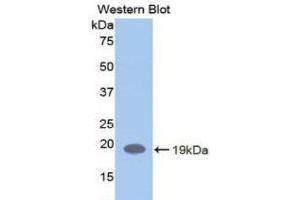 Western Blotting (WB) image for anti-Leukemia Inhibitory Factor Receptor alpha (LIFR) (AA 692-833) antibody (ABIN3208380) (LIFR antibody  (AA 692-833))