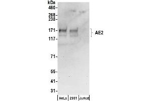 anti-Solute Carrier Family 4, Anion Exchanger, Member 2 (erythrocyte Membrane Protein Band 3-Like 1) (SLC4A2) (AA 1-50) antibody