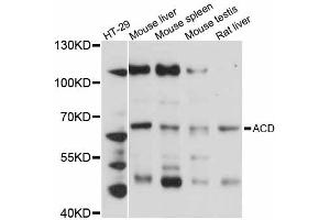 Western blot analysis of extracts of various cell lines, using ACD antibody (ABIN5997183) at 1:3000 dilution.