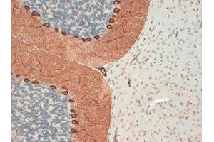 IP3 Receptor antibody  (C-Term)