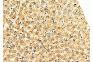 ABIN6264455 and ABIN6273151 at 1/100 staining Rat liver tissue by IHC-P.