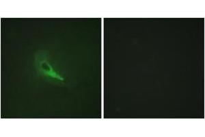 Immunofluorescence analysis of HeLa cells, using AKAP12 Antibody. (AKAP12 antibody  (AA 301-350))