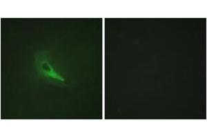 Immunofluorescence analysis of HeLa cells, using AKAP12 Antibody.