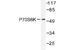 Image no. 1 for anti-Ribosomal Protein S6 Kinase, 70kDa, Polypeptide 1 (RPS6KB1) antibody (ABIN272053) (RPS6KB1 antibody)