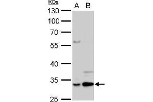 WB Image Annexin V antibody detects ANXA5 protein by Western blot analysis.