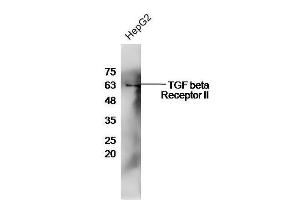 HepG2 cell lysates probed with Rabbit Anti-TGF beta R2 Polyclonal Antibody, Unconjugated  at 1:500 for 90 min at 37˚C.
