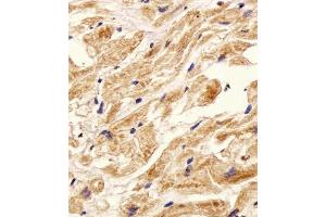 Immunohistochemical analysis of paraffin-embedded H. (ITGB8 antibody  (AA 197-231))