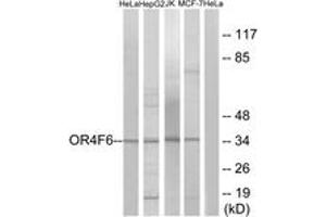 OR4F6 antibody  (AA 55-104)