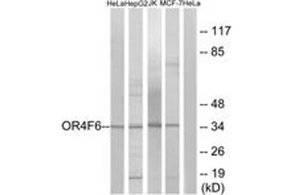 OR4F6 抗体  (AA 55-104)