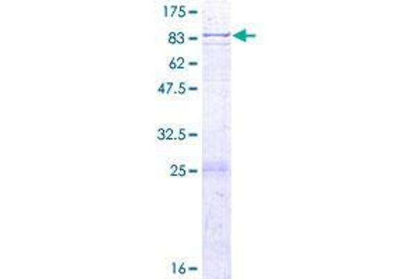 ELP3/KAT9 Protein (AA 1-547) (GST tag)