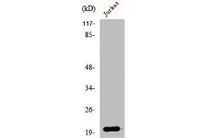 Western Blot analysis of Jurkat cells using AK6 Polyclonal Antibody (TAF9 antibody  (N-Term))