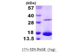 SDS-PAGE (SDS) image for Charcot-Leyden Crystal Protein (CLC) (AA 1-142) protein (His tag) (ABIN667436)
