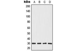 Western blot analysis of CBP86 expression in HepG2 (A), HeLa (B), SP2/0 (C), PC12 (D) whole cell lysates. (CABYR antibody  (Center))