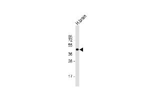 Anti-NI Antibody (N-term) at 1:1000 dilution + human brain lysate Lysates/proteins at 20 μg per lane. (NIPAL4 antibody  (N-Term))