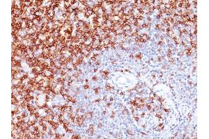 Immunohistochemistry (IHC) image for anti-Protein tyrosine Phosphatase, Receptor Type, C (PTPRC) antibody (ABIN6940446)
