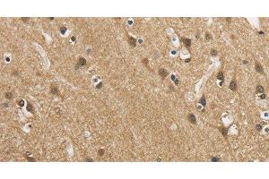Immunohistochemistry of paraffin-embedded Human brain using GAS7 Polyclonal Antibody at dilution of 1:50 (GAS7 antibody)