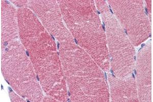 Human Skeletal Muscle: Formalin-Fixed, Paraffin-Embedded (FFPE) (ACTN2 antibody  (AA 11-347))