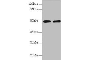 Western blot All lanes: ZBTB25 antibody at 1. (ZBTB25 antibody  (AA 266-435))