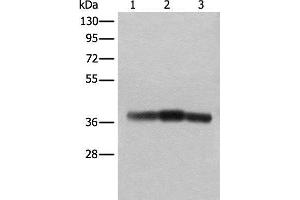Western blot analysis of Rat brain tissue Mouse brain tissue and Human cerebrum tissue lysates using ATAD1 Polyclonal Antibody at dilution of 1:800