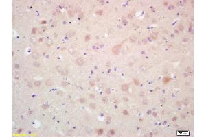 Formalin-fixed and paraffin embedded rat brain labeled with Rabbit Anti MAP LC3 Beta Polyclonal Antibody, Unconjugated (ABIN1386128) at 1:200 followed by conjugation to the secondary antibody and DAB staining