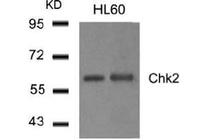 Western blot analysis of extract from HL60 cells using Chk2. (CHEK2 antibody  (AA 514-518))