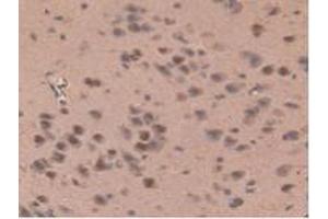 IHC-P analysis of Rat Brain Tissue, with DAB staining. (IL17RD antibody  (AA 356-605))