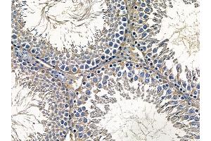 ABIN6257715 and ABIN6275291 at 1/100 staining rat testis tissue by IHC-P. (NPDC1 antibody  (Internal Region))