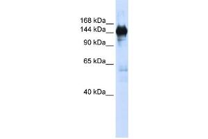 Western Blotting (WB) image for anti-Phosphoribosylformylglycinamidine Synthase (PFAS) antibody (ABIN2458991) (PFAS antibody)