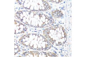 Immunohistochemistry of paraffin-embedded human colon using HSD17B10 antibody. (HSD17B10 antibody  (AA 1-261))