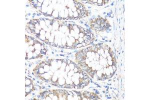 Immunohistochemistry of paraffin-embedded human colon using HSD17B10 antibody. (HSD17B10 antibody  (AA 1-261))