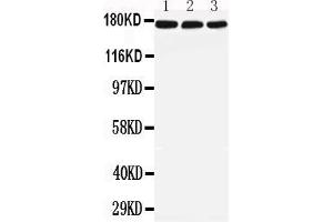 Anti-LRP5 antibody, All Western blottingAll lanes: Anti-LRP5 at 0. (LRP5 antibody  (C-Term))