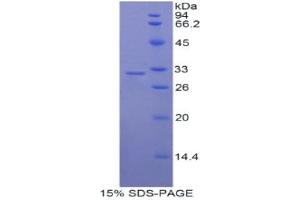 SDS-PAGE analysis of Rat Myosin IC Protein. (Myosin IC Protein (MYO1C))