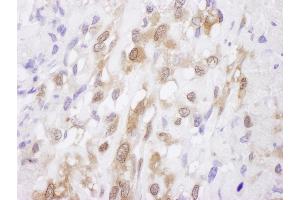 Immunohistochemistry (IHC) image for anti-Superoxide Dismutase 1, Soluble (SOD1) (AA 54-104) antibody (ABIN7453945) (SOD1 antibody  (AA 54-104))