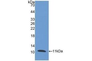 Detection of Recombinant PI3, Human using Polyclonal Antibody to Peptidase Inhibitor 3, Skin Derived (PI3) (PI3 antibody  (AA 41-117))