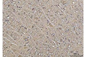 IHC analysis of YWHAE using anti-YWHAE antibody (ABIN7600163). (YWHAE antibody  (AA 16-163))