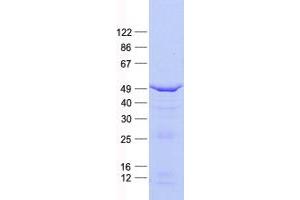 Validation with Western Blot