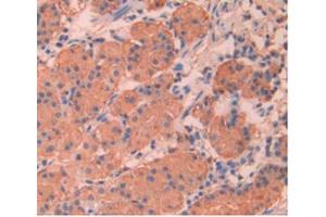 Immunohistochemistry (IHC) image for anti-Apolipoprotein A-V (APOA5) (AA 167-335) antibody (ABIN7427942)