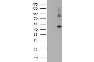 Image no. 2 for anti-Carboxypeptidase A2 (Pancreatic) (CPA2) antibody (ABIN1497595) (Carboxypeptidase A2 antibody)