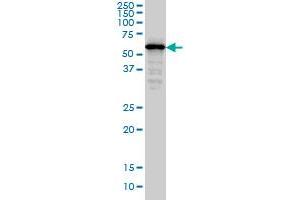 SMAD4 monoclonal antibody (M02), clone 3E2 Western Blot analysis of SMAD4 expression in Hela S3 NE . (SMAD4 antibody  (AA 1-552))