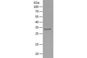 Western Blotting (WB) image for DNA Replication Helicase 2 Homolog (DNA2) (AA 145-391) protein (His tag) (ABIN7122686) (DNA2 Protein (AA 145-391) (His tag))