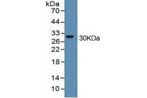 Western Blotting (WB) image for High Mobility Group Box 1 (HMGB1) ELISA Kit (ABIN6574155)