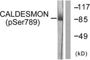 Western blot analysis of extracts from HeLa cells treated with EGF 200ng/ml 30', using Caldesmon (Phospho-Ser789) Antibody. (Caldesmon antibody  (pSer789))