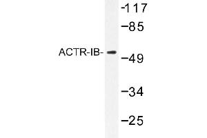 Image no. 1 for anti-Activin A Receptor, Type IB (ACVR1B) antibody (ABIN272185)